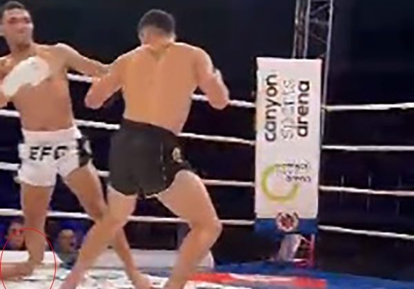 Talihsiz sporcunun maç esnasında kaval kemiği kırıldı