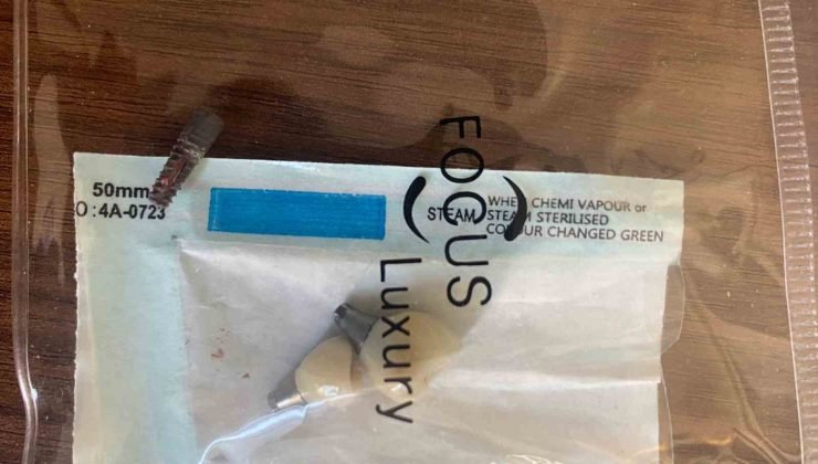 İsveç menşeli implant yaptırdığını sanan gurbetçi gittiği bir başka hekimde hayatının şokunu yaşadı