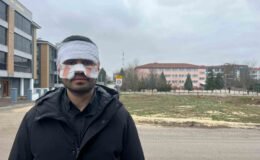 Rehber öğretmenin yüzüne sıcak çay fırlattığı fizik öğretmeni feci şekilde yandı