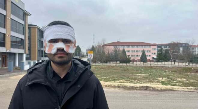 Rehber öğretmenin yüzüne sıcak çay fırlattığı fizik öğretmeni feci şekilde yandı