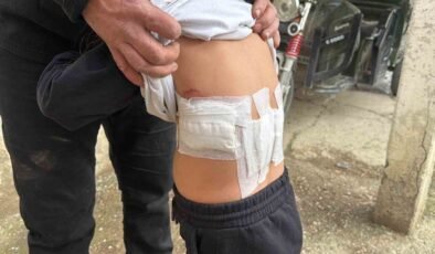 Saldırgan eşek evinin önünde oynayan 5 yaşındaki çocuğa kabusu yaşattı