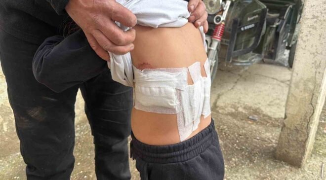 Saldırgan eşek evinin önünde oynayan 5 yaşındaki çocuğa kabusu yaşattı