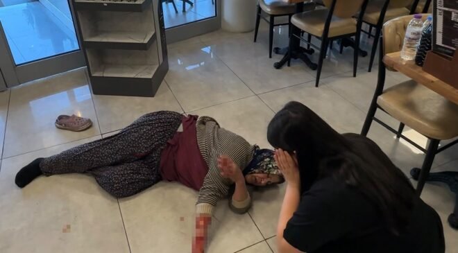 Tekmelere aldırmayan köpek kadının kolunu kopardı