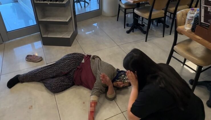 Tekmelere aldırmayan köpek kadının kolunu kopardı