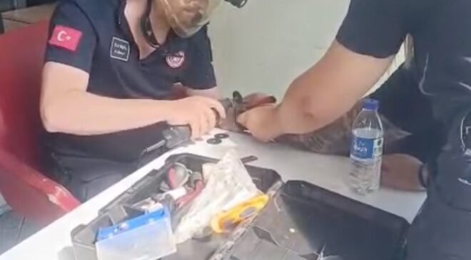 Bileğinde sıkışan kelepçe itfaiyenin müdahalesiyle çıkartıldı